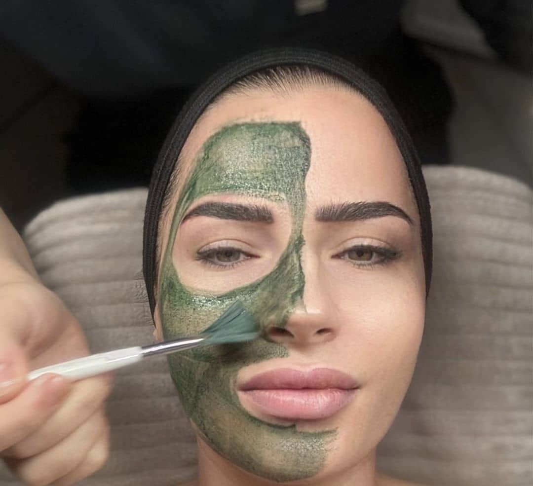 Bio Microneedling – Green Sea Peel